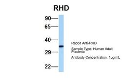 RHD Rabbit anti-Human, Polyclonal, Novus Biologicals 0.1ml; Unconjugated:Antibodies,